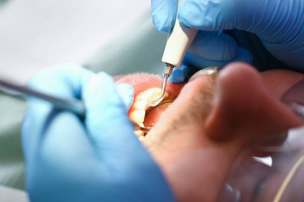 Best Urgent Care for Lost Fillings or Crowns in Pittsburg, KS