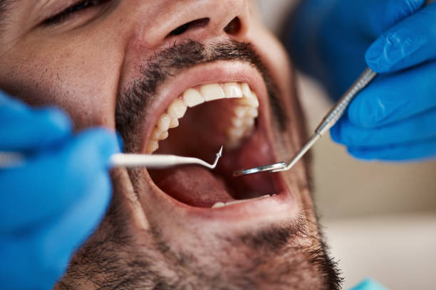 Best Emergency Dental Care for Broken or Chipped Teeth in Pittsburg, KS